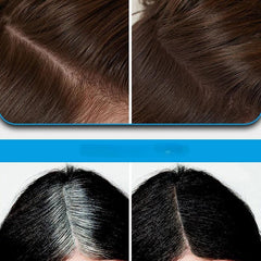 💗LAST DAY SALE 60% OFF⚡50K+ SOLD💕Multi-Functional Instant Concealer Hairline Powder