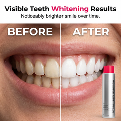 🌸LAST DAY SPECIAL PRICE!!🌸 ⚡ Stain‑Removing Whitening Mouthwash – Deep Clean Stains, Brighten Teeth & Freshen Breath Instantly ✨
