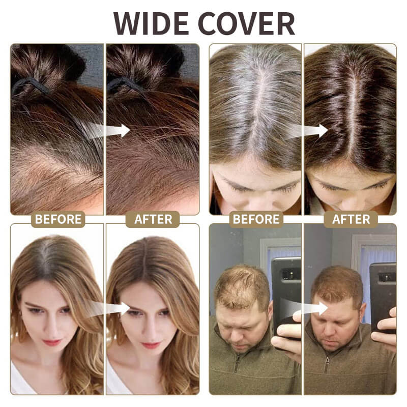 💞Buy 1 Get 1 Free💞Upgrade Magic Root Cover Up 2