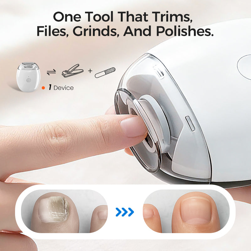 🎁Year-End Sale 70% OFF⚡Universal Automatic Fingernail Grinder for Adults and Children