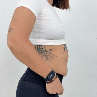 🔥Summer Hot Sale - BUY 1 GET 1 FREE!!⚡50K+ SOLD!💃Women's Tummy Control Butt-Lifting Shapewear