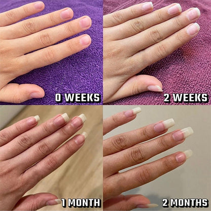 💮Hot Sale 50% OFF Special Price £7.99🌸Moisturize Strengthen Brighten Nails Growth Oil