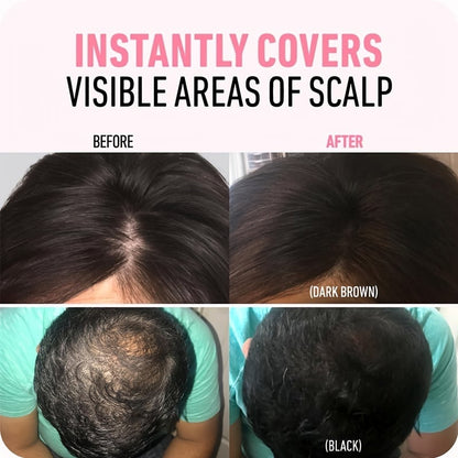 🔥BUY 2 GET 1 FREE💗Hairline Powder - Magic Root Cover Up (fit all hair color)