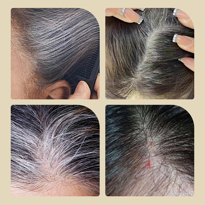 🥰LAST DAY - BUY 1 GET 1 FREE!!🥰Safe and Convenient Comb Hair Dye (Free shipping today!!)