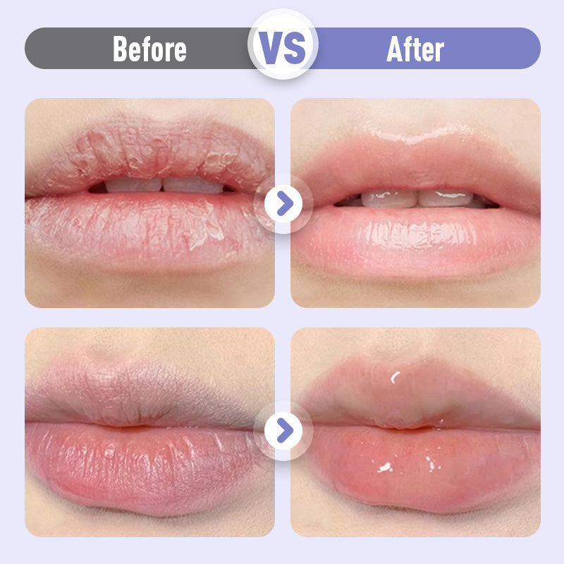 📢📢50 %  OFF❗Plumping & Anti-Wrinkle Hydrating Lip Serum💧💋