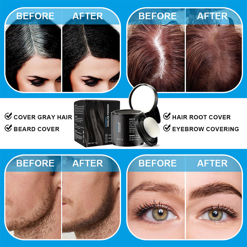 💗LAST DAY SALE 60% OFF⚡50K+ SOLD💕Multi-Functional Instant Concealer Hairline Powder