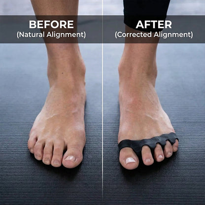 💞BUY 1 GET 1 FREE + 50% OFF! 🥳💞50K+ SOLD!💥🖌️Reusable & Washable Foot Alignment Correctors